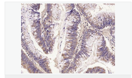 605830d5dd54e.png image.png